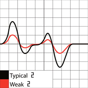 Weak SIgnal